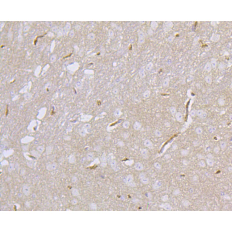 Immunohistochemistry - Anti-DLG4 Antibody (A10841) - Antibodies.com