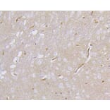 Immunohistochemistry - Anti-DLG4 Antibody (A10841) - Antibodies.com