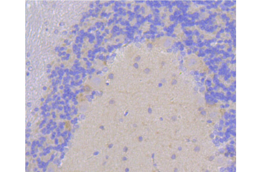 Immunohistochemistry - Anti-DLG4 Antibody (A10841) - Antibodies.com