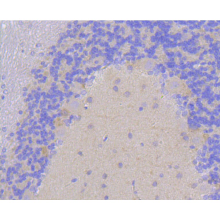 Immunohistochemistry - Anti-DLG4 Antibody (A10841) - Antibodies.com