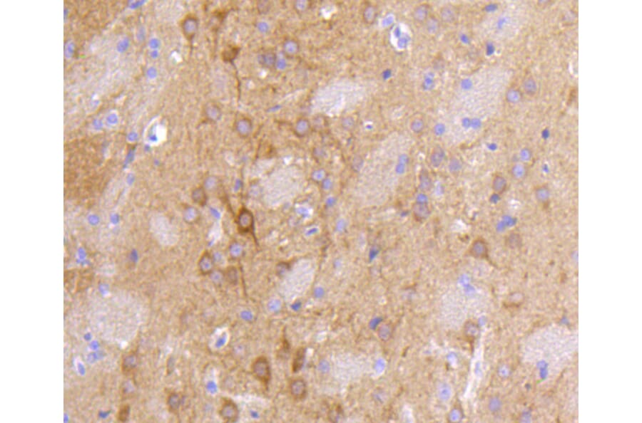 Immunohistochemistry - Anti-DLG4 Antibody (A10841) - Antibodies.com