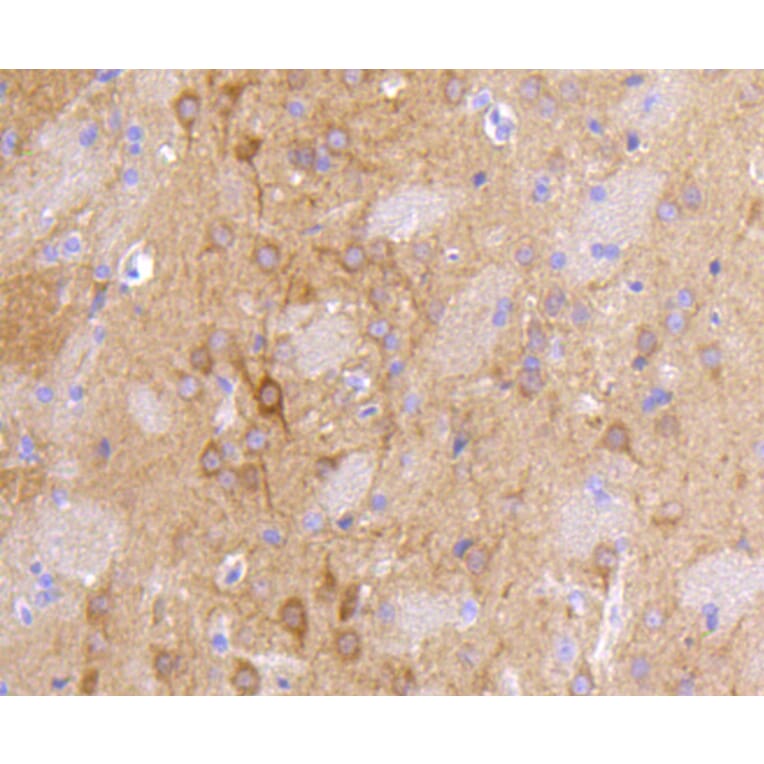 Immunohistochemistry - Anti-DLG4 Antibody (A10841) - Antibodies.com