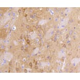 Immunohistochemistry - Anti-DLG4 Antibody (A10841) - Antibodies.com