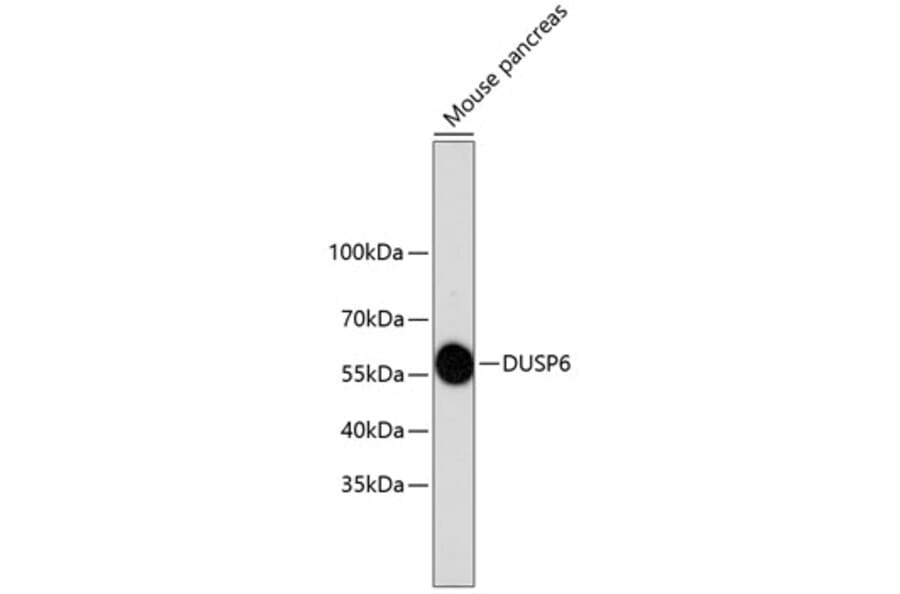 Western Blot - Anti-DUSP6 Antibody (A10847) - Antibodies.com