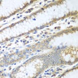 Immunohistochemistry - Anti-ERp57 Antibody (A13098) - Antibodies.com