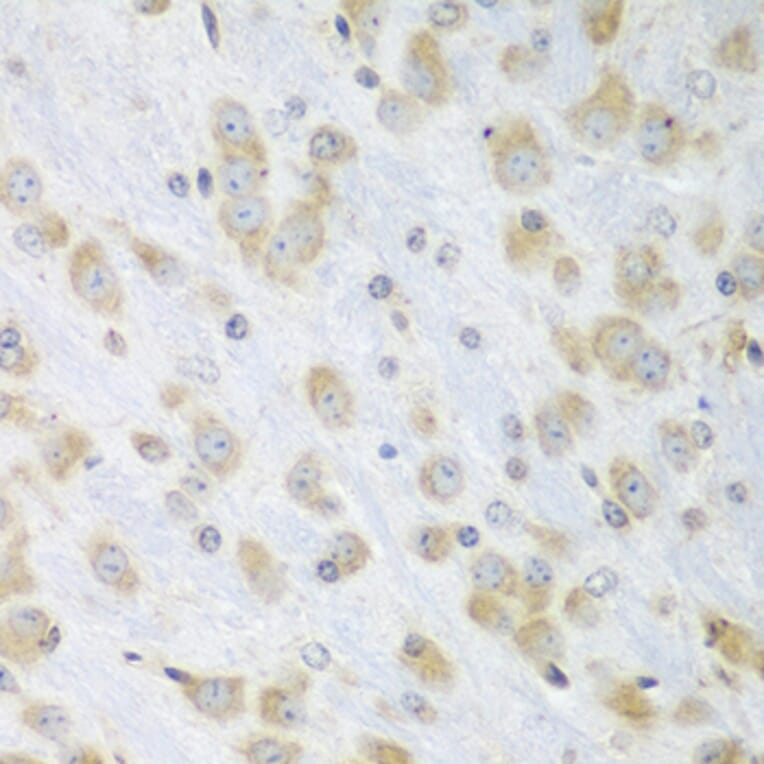 Immunohistochemistry - Anti-ERp57 Antibody (A13098) - Antibodies.com