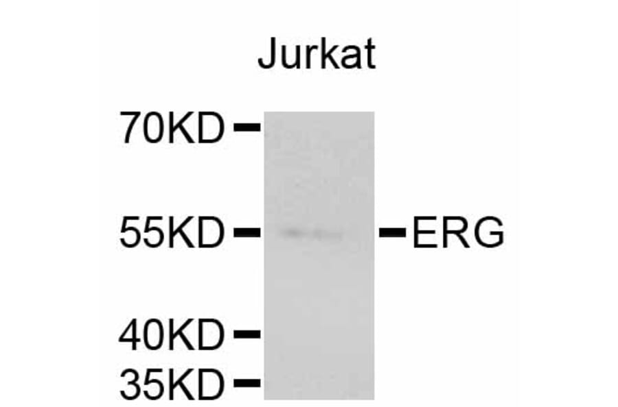 Western Blot - Anti-ERG Antibody (A10855) - Antibodies.com