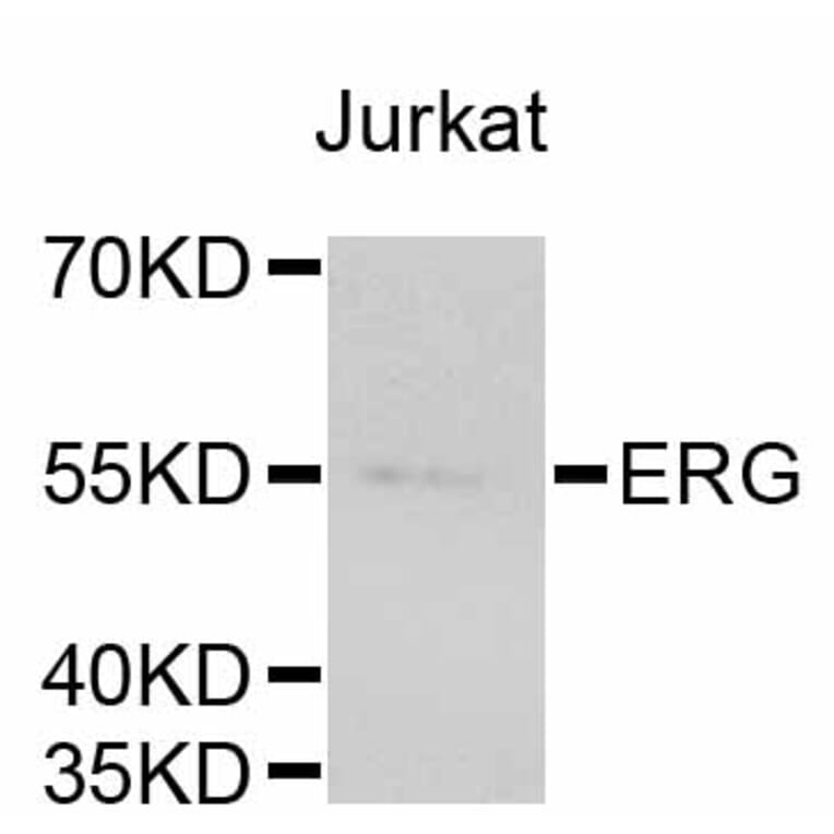 Western Blot - Anti-ERG Antibody (A10855) - Antibodies.com