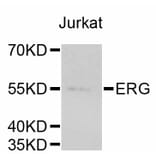 Western Blot - Anti-ERG Antibody (A10855) - Antibodies.com