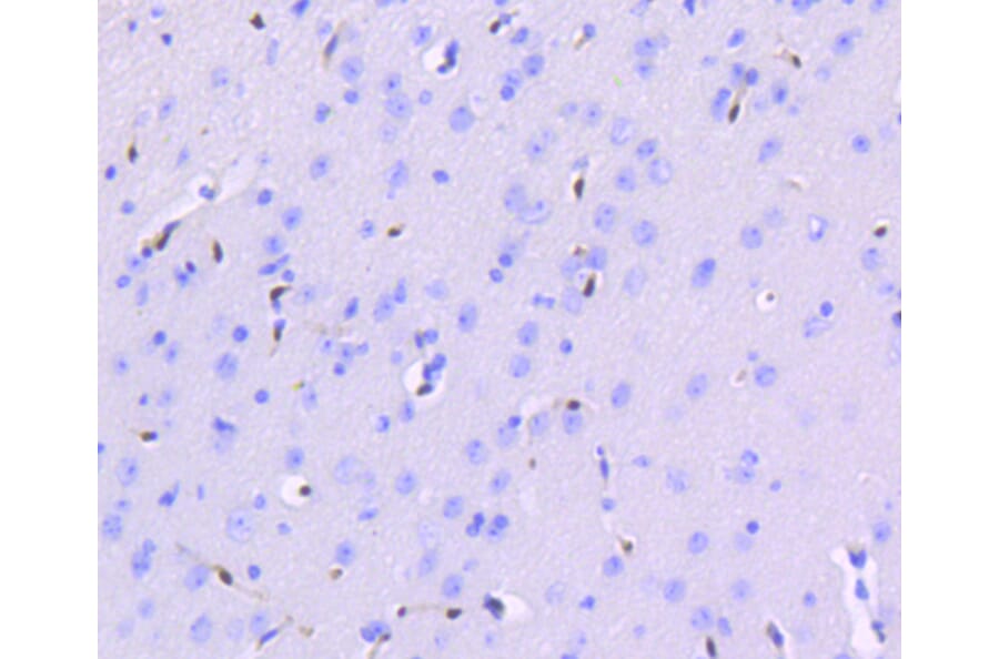 Immunohistochemistry - Anti-ERG Antibody (A10855) - Antibodies.com