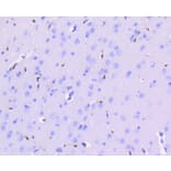 Immunohistochemistry - Anti-ERG Antibody (A10855) - Antibodies.com