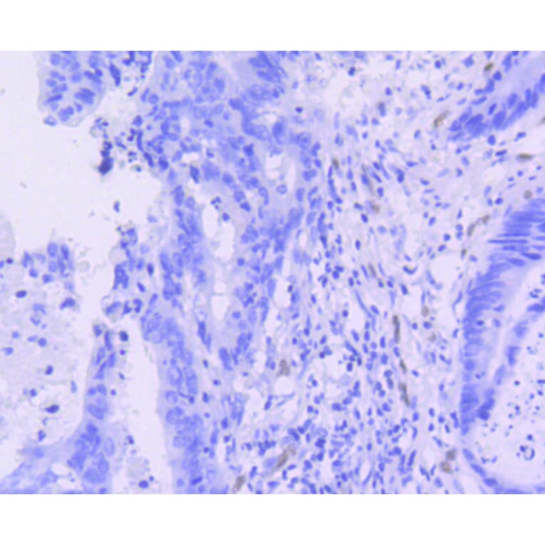 Immunohistochemistry - Anti-ERG Antibody (A10855) - Antibodies.com