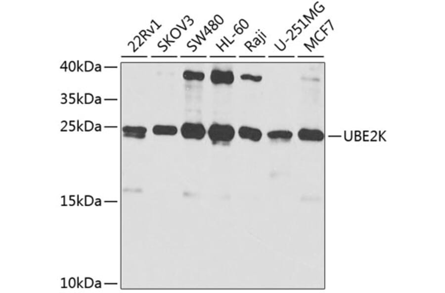 Western Blot - Anti-HIP2/LIG Antibody (A13103) - Antibodies.com
