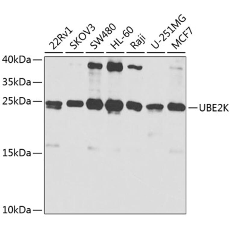 Western Blot - Anti-HIP2/LIG Antibody (A13103) - Antibodies.com