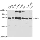 Western Blot - Anti-HIP2/LIG Antibody (A13103) - Antibodies.com
