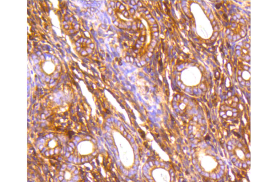 Immunohistochemistry - Anti-FLNA Antibody (A10865) - Antibodies.com