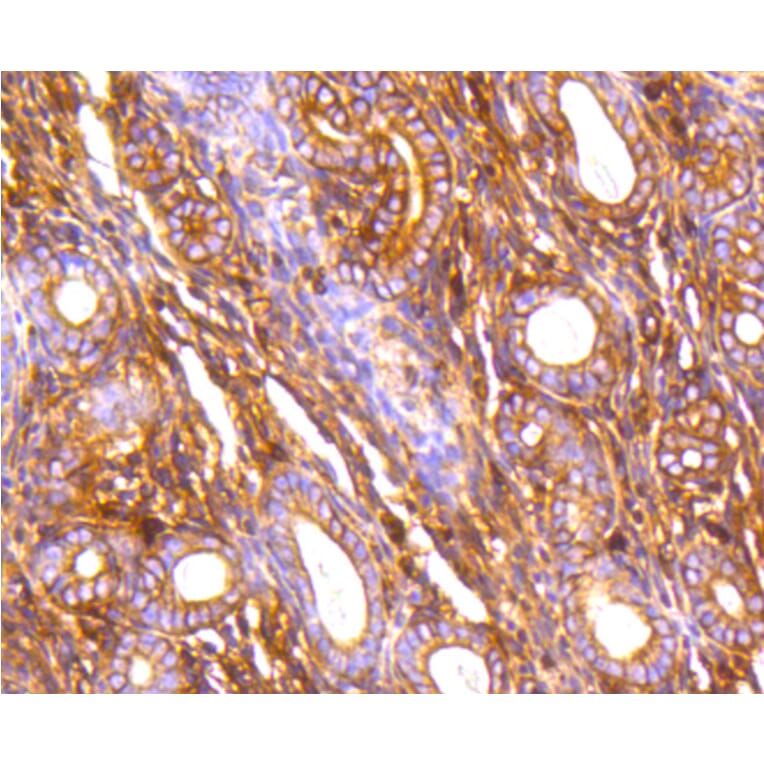 Immunohistochemistry - Anti-FLNA Antibody (A10865) - Antibodies.com