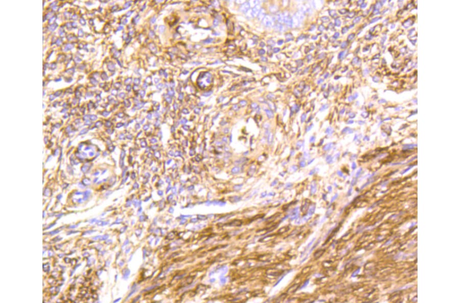 Immunohistochemistry - Anti-FLNA Antibody (A10865) - Antibodies.com