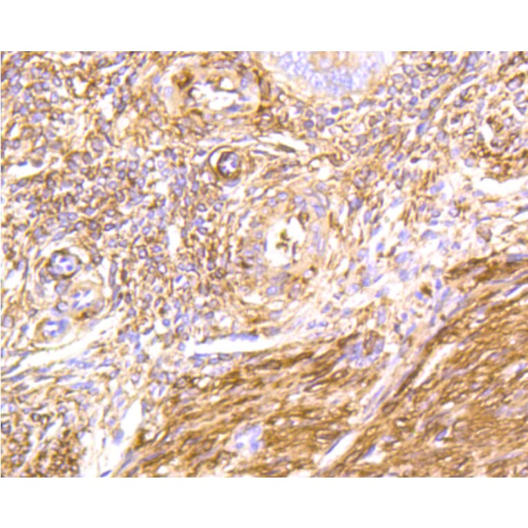 Immunohistochemistry - Anti-FLNA Antibody (A10865) - Antibodies.com