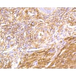 Immunohistochemistry - Anti-FLNA Antibody (A10865) - Antibodies.com