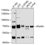 Western Blot - Anti-IFNAR1 Antibody (A10869) - Antibodies.com