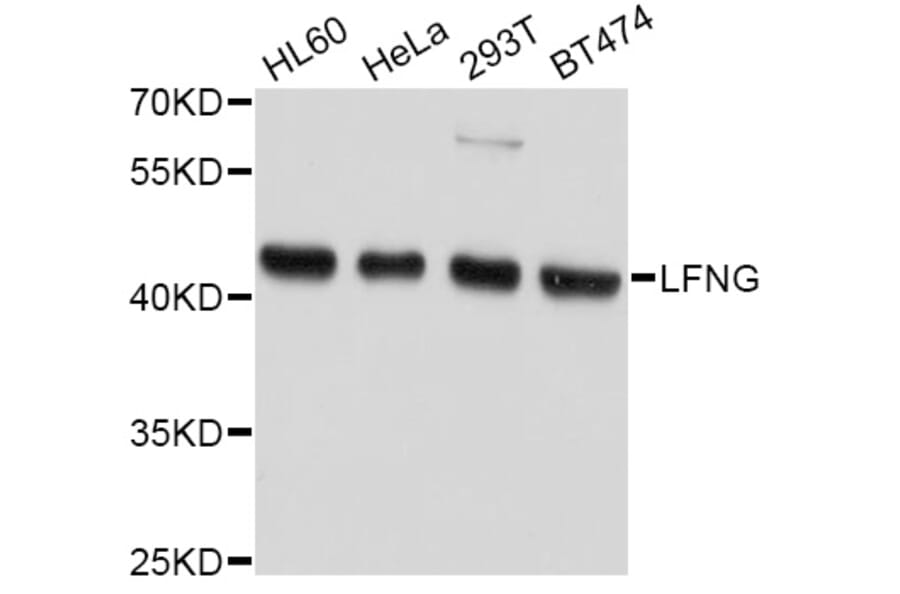 Western Blot - Anti-LFNG Antibody (A10872) - Antibodies.com