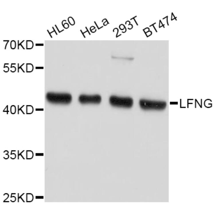 Western Blot - Anti-LFNG Antibody (A10872) - Antibodies.com