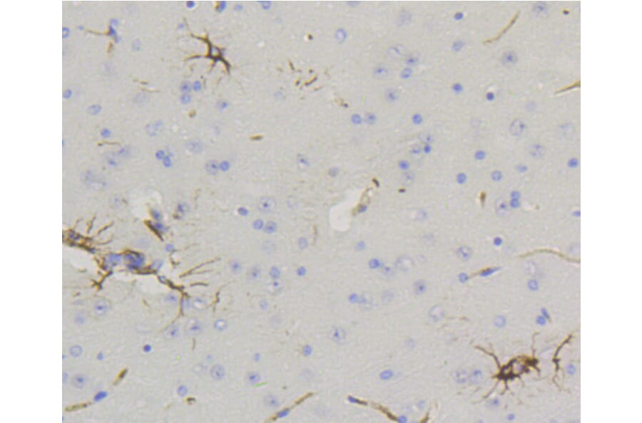 Immunohistochemistry - Anti-GFAP Antibody (A10873) - Antibodies.com