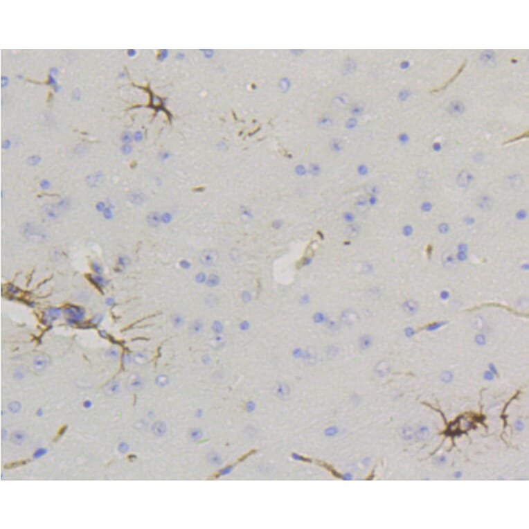 Immunohistochemistry - Anti-GFAP Antibody (A10873) - Antibodies.com
