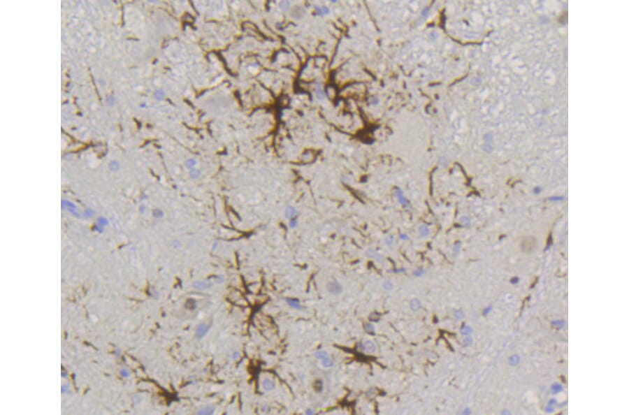 Immunohistochemistry - Anti-GFAP Antibody (A10873) - Antibodies.com