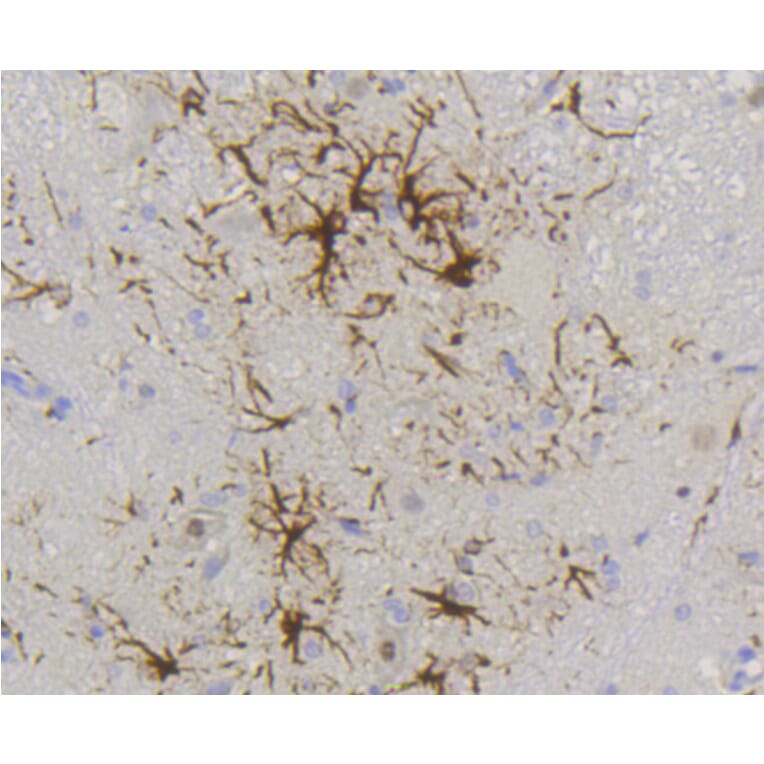 Immunohistochemistry - Anti-GFAP Antibody (A10873) - Antibodies.com