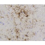 Immunohistochemistry - Anti-GFAP Antibody (A10873) - Antibodies.com