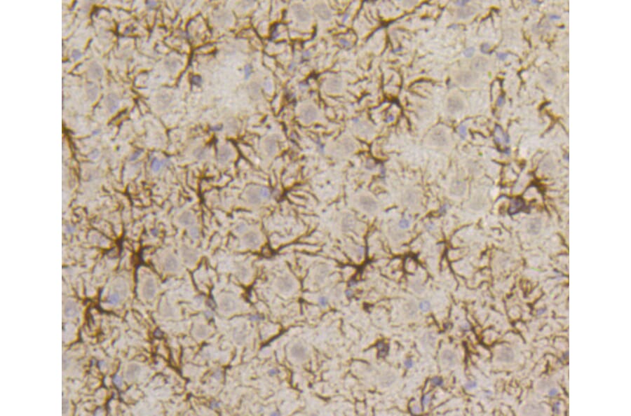 Immunohistochemistry - Anti-GFAP Antibody (A10873) - Antibodies.com