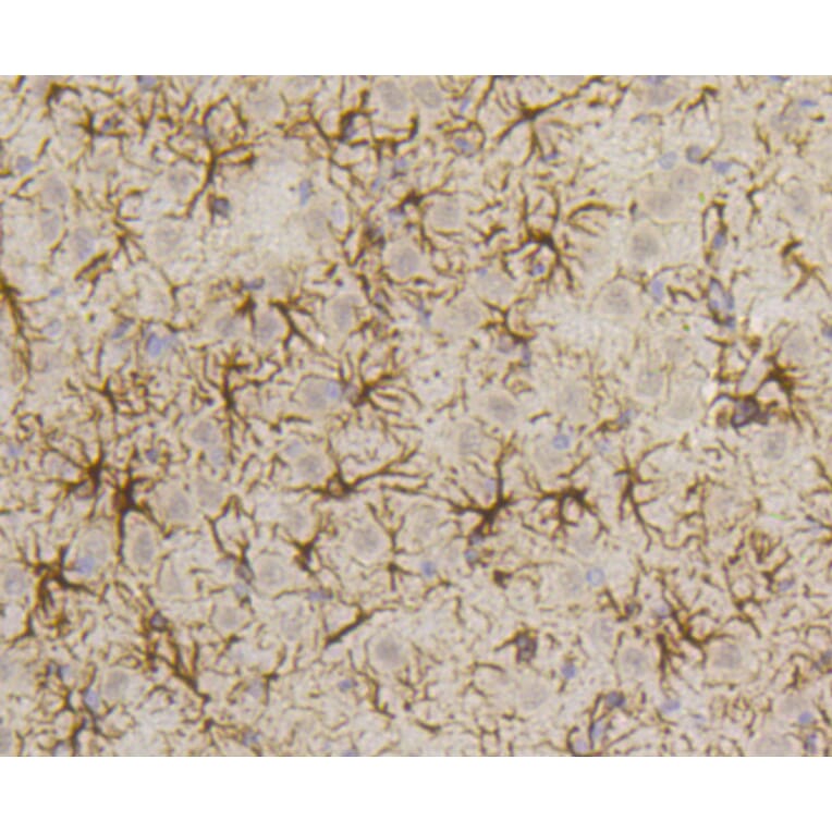 Immunohistochemistry - Anti-GFAP Antibody (A10873) - Antibodies.com