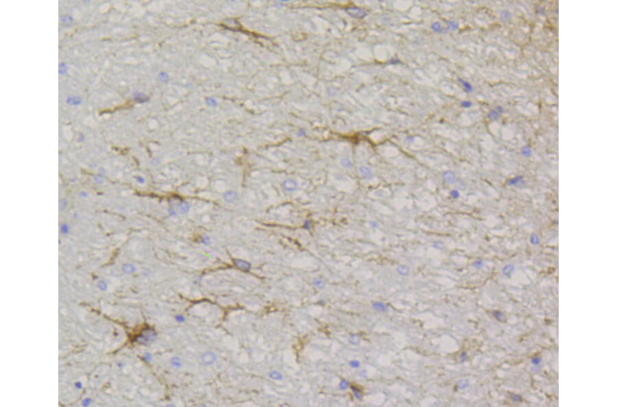 Immunohistochemistry - Anti-GFAP Antibody (A10873) - Antibodies.com