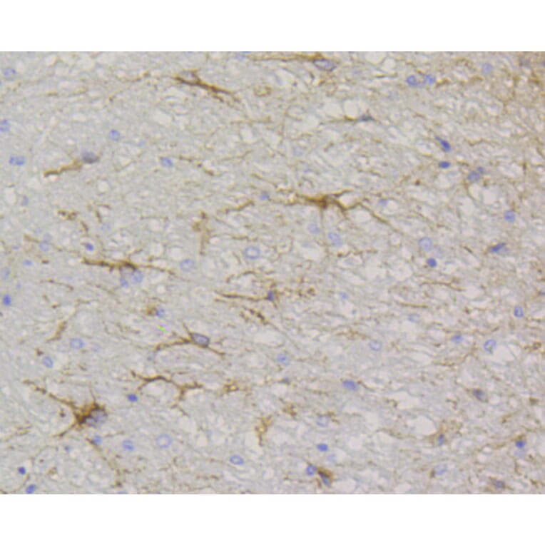 Immunohistochemistry - Anti-GFAP Antibody (A10873) - Antibodies.com