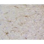 Immunohistochemistry - Anti-GFAP Antibody (A10873) - Antibodies.com