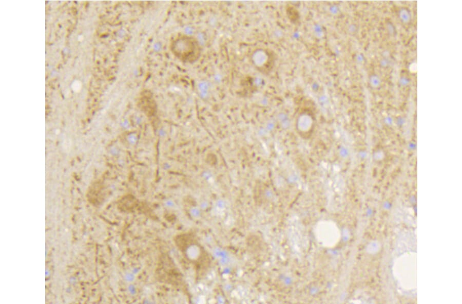 Immunohistochemistry - Anti-GRM5 Antibody (A10876) - Antibodies.com
