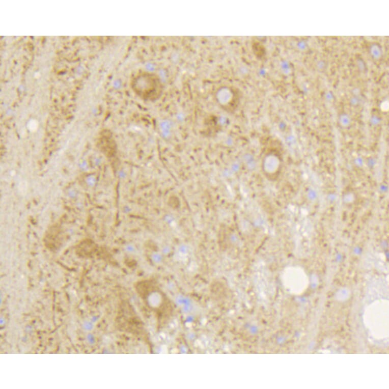 Immunohistochemistry - Anti-GRM5 Antibody (A10876) - Antibodies.com