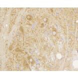 Immunohistochemistry - Anti-GRM5 Antibody (A10876) - Antibodies.com