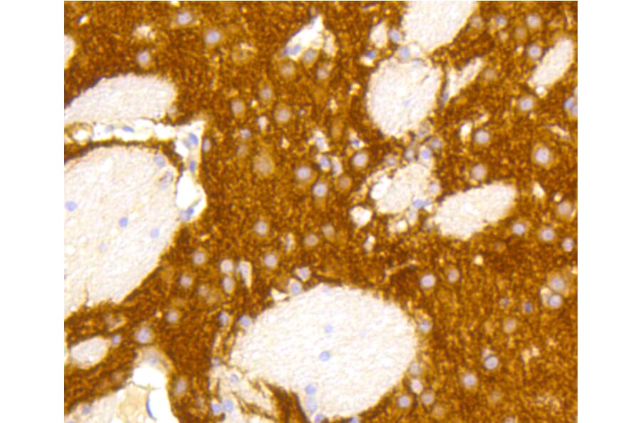 Immunohistochemistry - Anti-GRM5 Antibody (A10876) - Antibodies.com