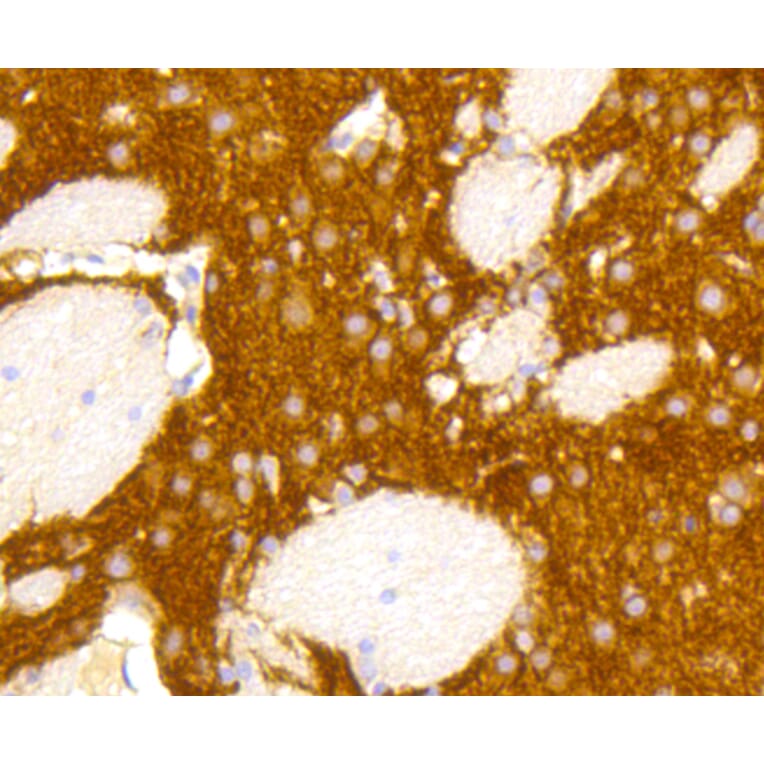 Immunohistochemistry - Anti-GRM5 Antibody (A10876) - Antibodies.com