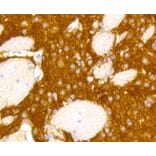 Immunohistochemistry - Anti-GRM5 Antibody (A10876) - Antibodies.com