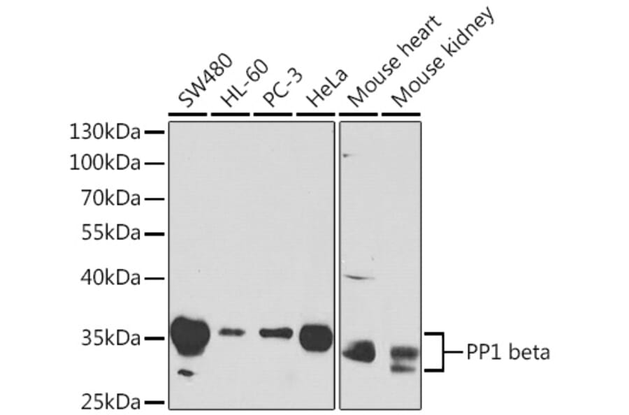 Western Blot - Anti-PPP1CB Antibody (A13118) - Antibodies.com