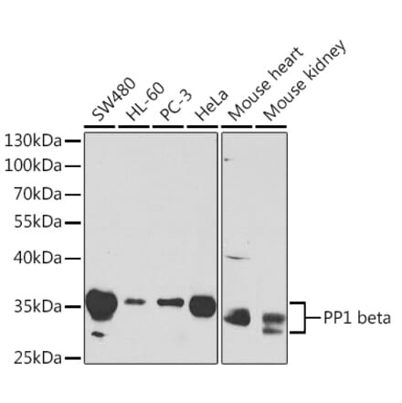 Western Blot - Anti-PPP1CB Antibody (A13118) - Antibodies.com