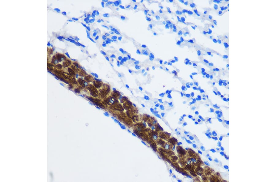Immunohistochemistry - Anti-PPP1CB Antibody (A13118) - Antibodies.com