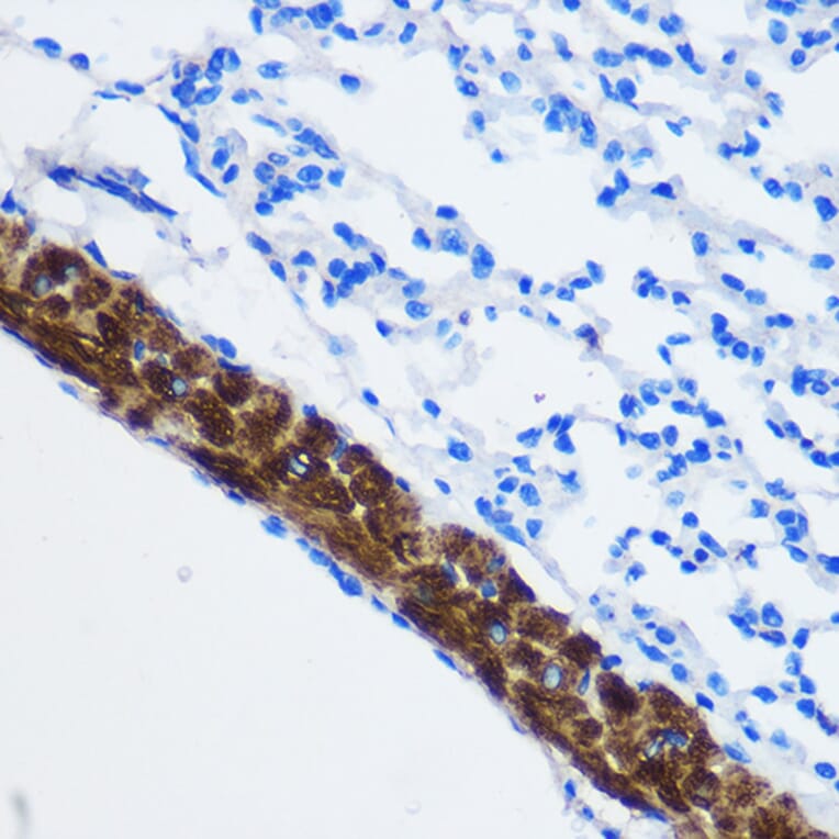 Immunohistochemistry - Anti-PPP1CB Antibody (A13118) - Antibodies.com