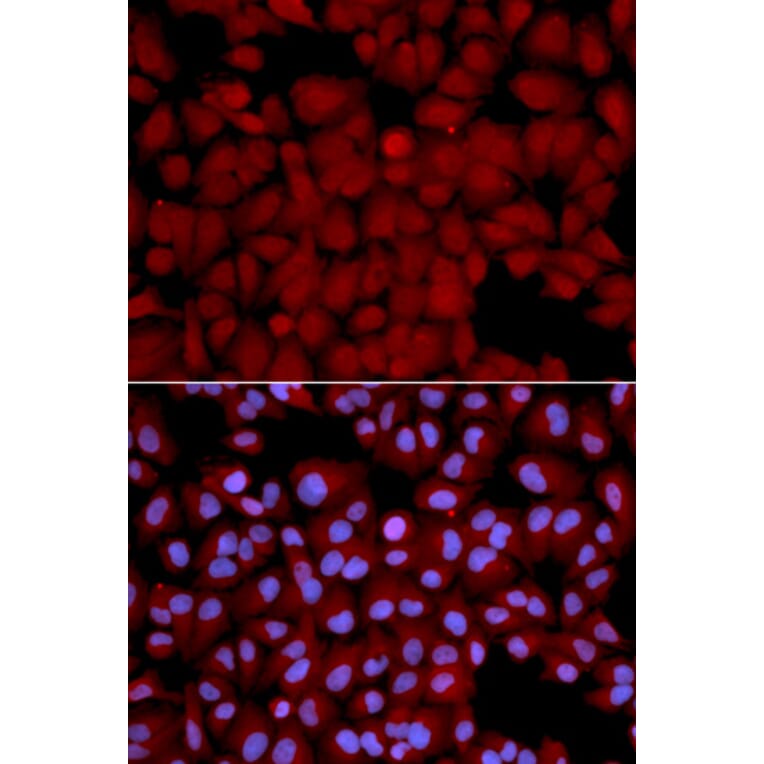 Immunofluorescence - Anti-PPP1CB Antibody (A13118) - Antibodies.com