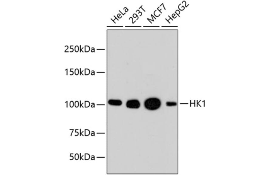 Western Blot - Anti-HK1 Antibody (A10886) - Antibodies.com