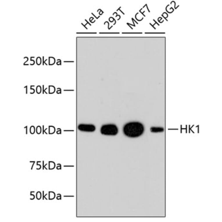 Western Blot - Anti-HK1 Antibody (A10886) - Antibodies.com